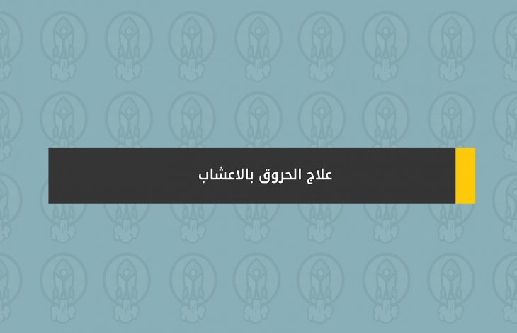 علاج الحروق بالاعشاب