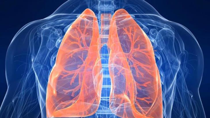 الجلطة الرئوية