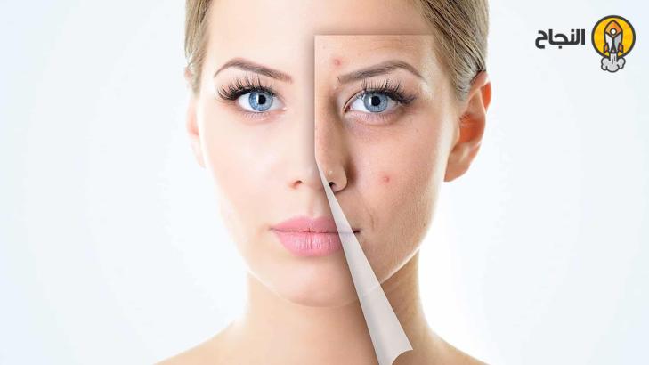 أشهر الأمراض الجلدية وطرق علاجها