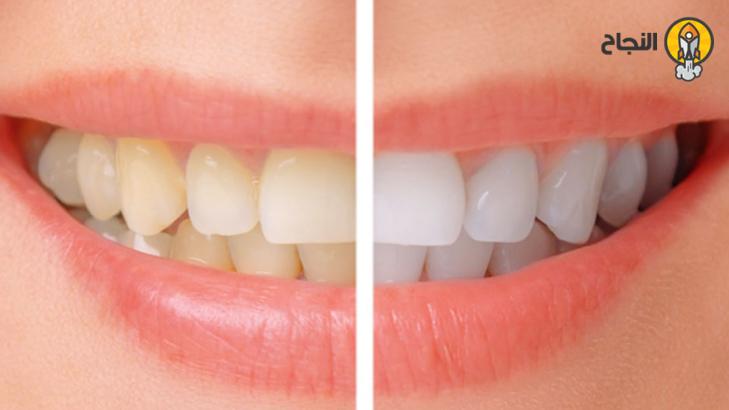 8 طرق طبيعية للحصول على أسنان بيضاء ناصعة