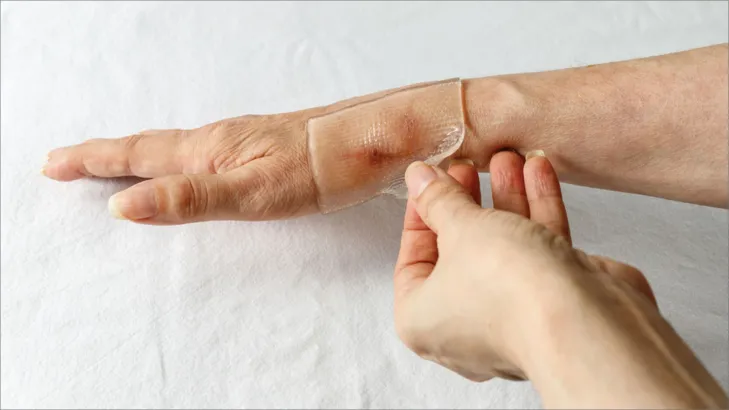 تعرف على أنواع الضمادات