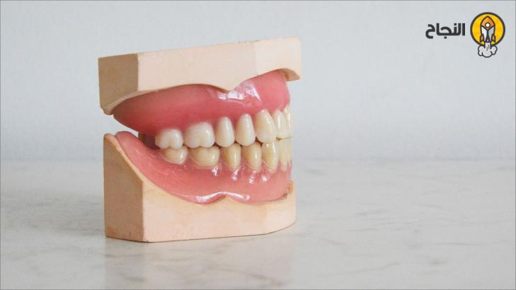 تركيبات الأسنان: تعريفها، وأنواعها، وعيوبها